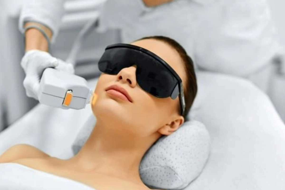 Person receiving a cosmetic laser treatment on the face while wearing protective eyewear, lying on a cushioned surface.