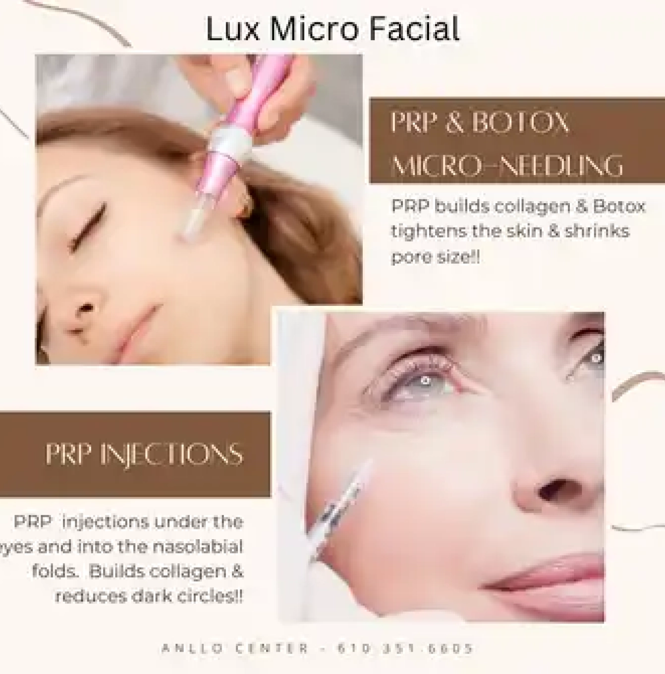 A picture of some people and text that says lux micro facial.