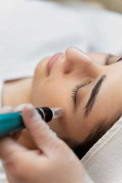 person-getting-micro-needling-beauty-treatment