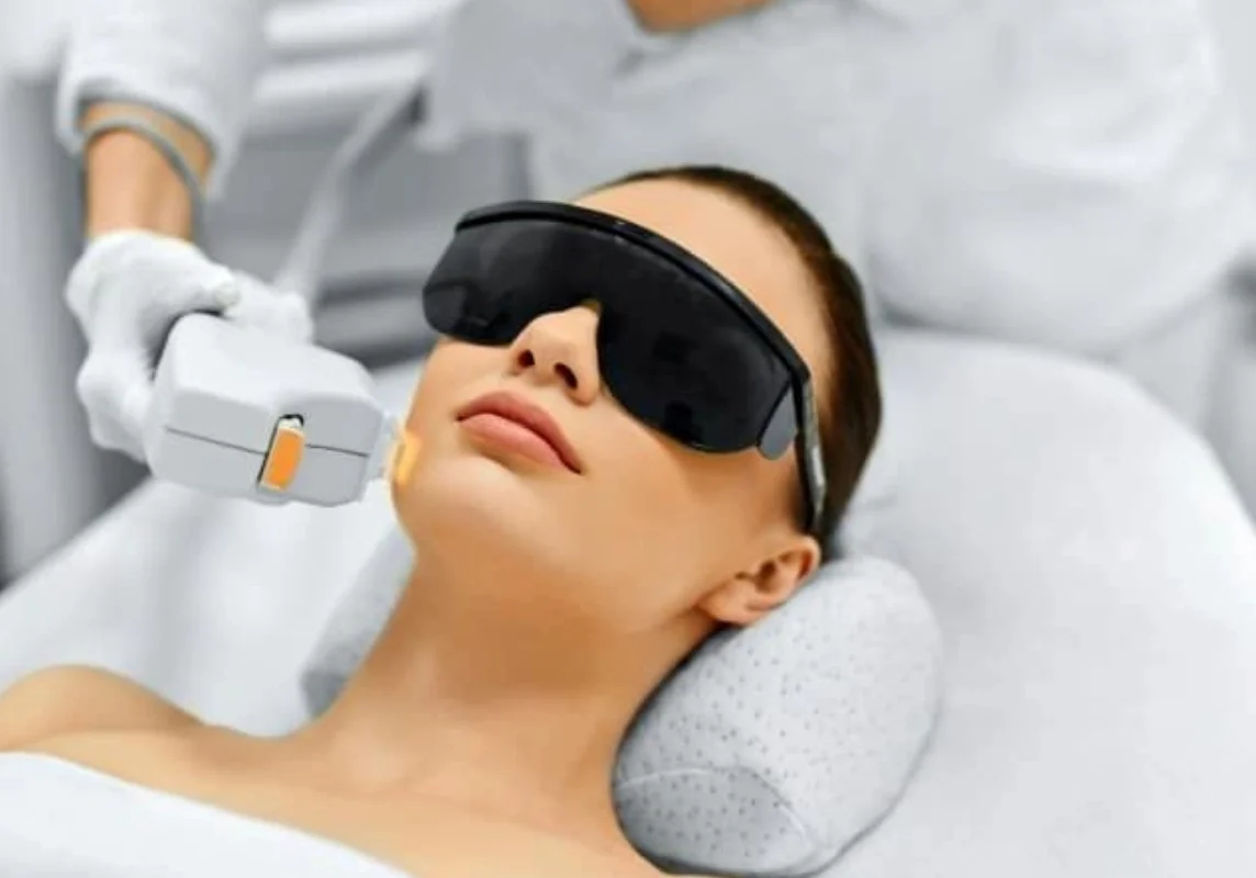 Person receiving a cosmetic laser treatment on the face while wearing protective eyewear, lying on a cushioned surface.